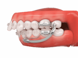 {{brizy_dc_image_alt imageSrc=