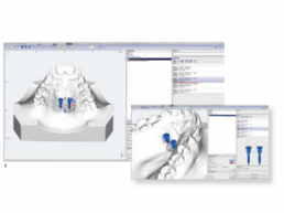 {{brizy_dc_image_alt imageSrc=